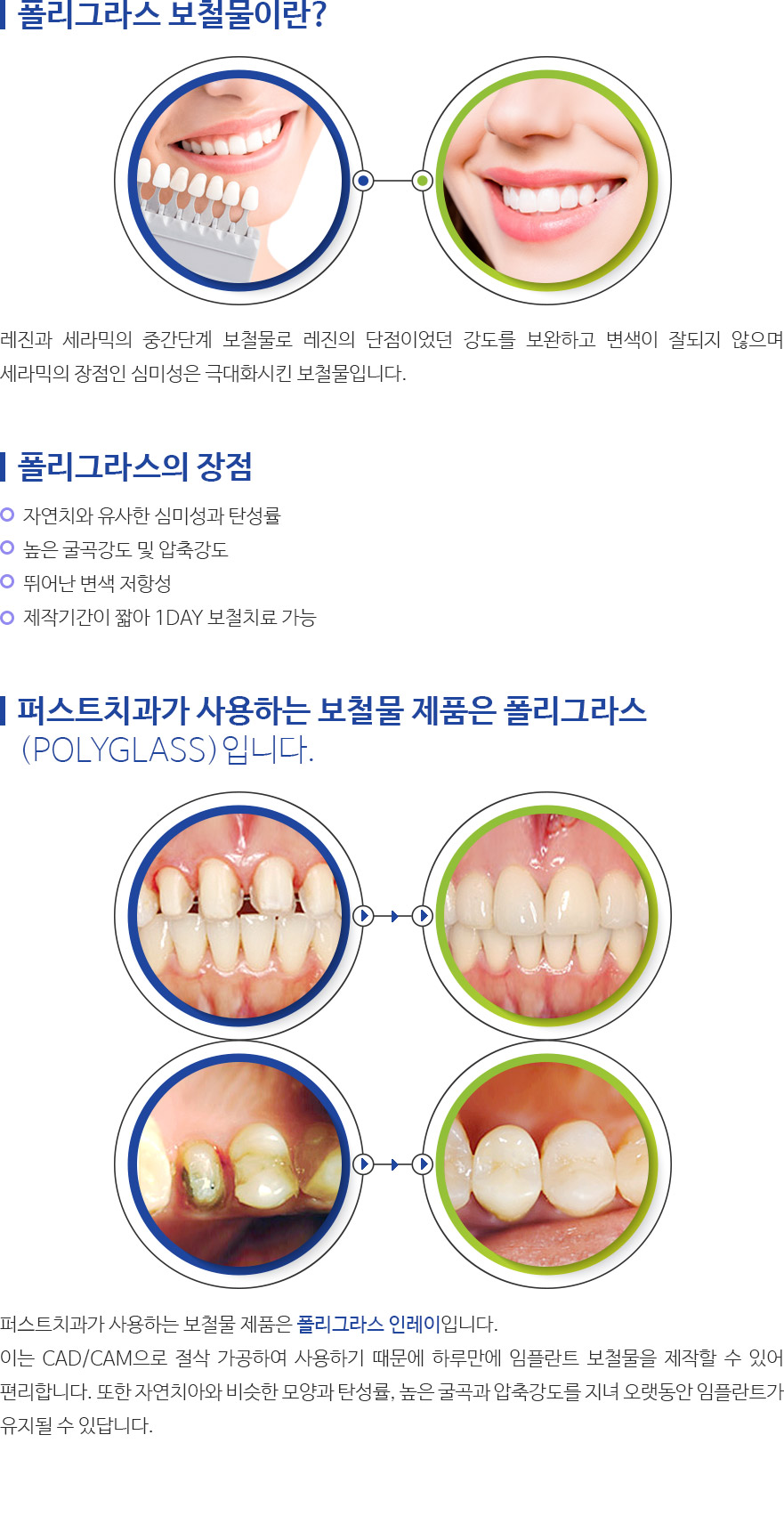 인천퍼스트치과 서브컨텐츠 내용